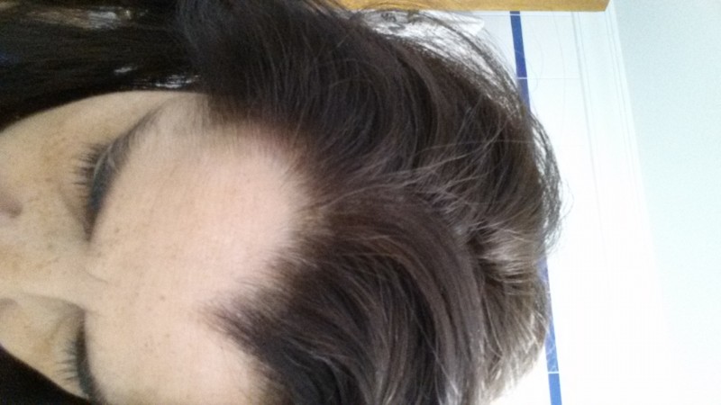 Sin canas