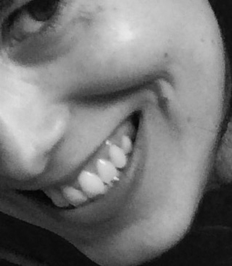Sorriso Desafio #youzz #parodontax
