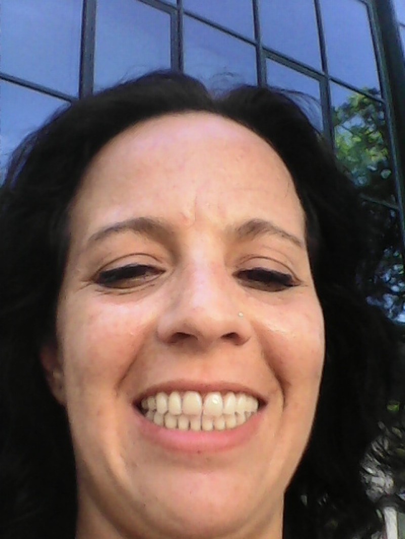 os meus dentes lindos depois de parondontax