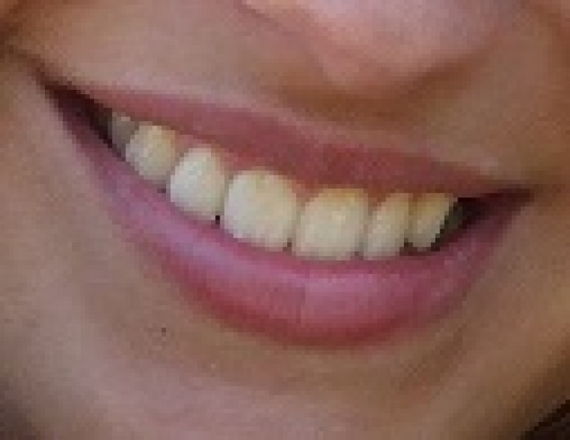 O meu novo sorriso Parodontax