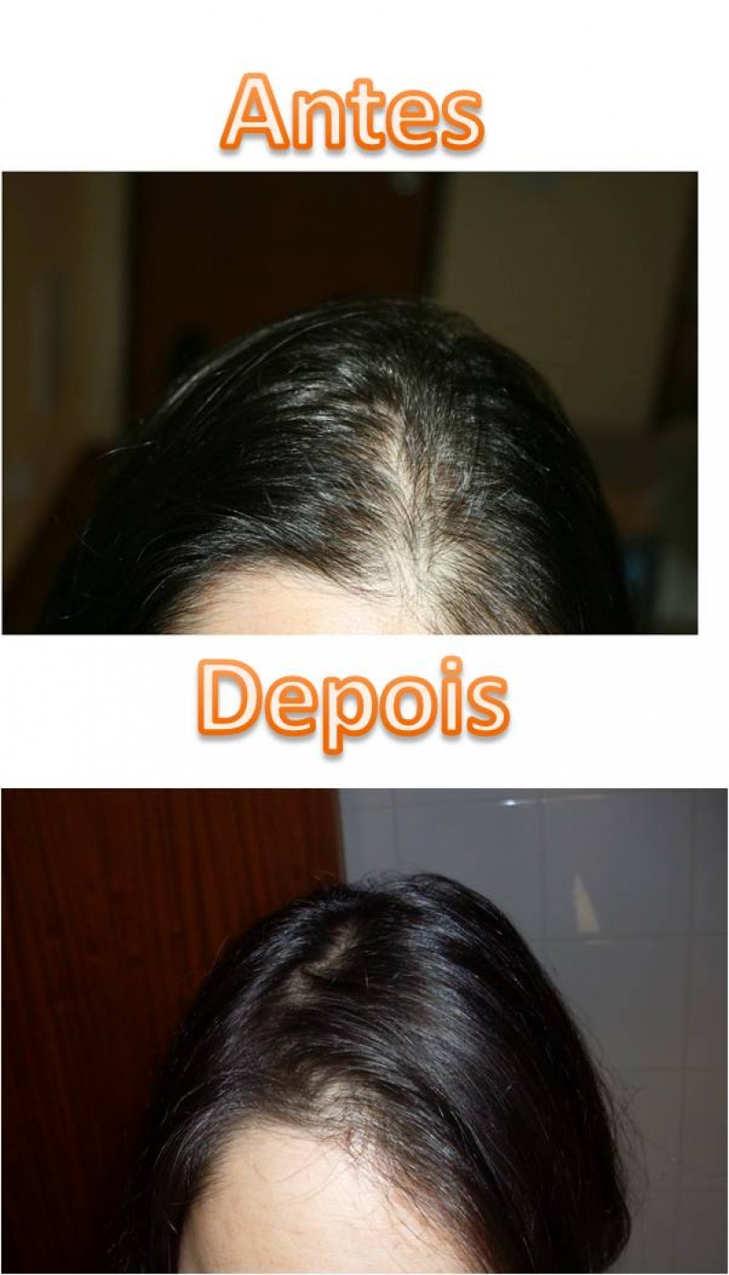 Antes e depois...