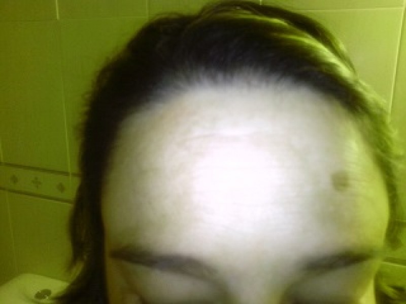 antes