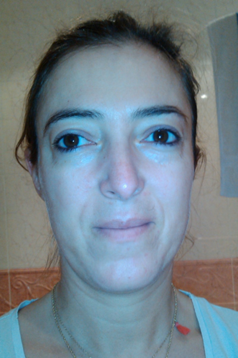 Depois 